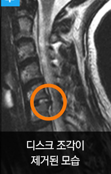 디스크 조각이 제거된 모습